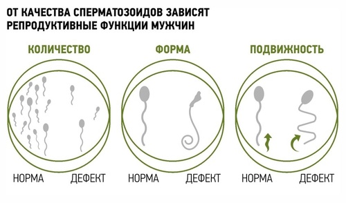 Фото: Качество спермы при варикоцеле
