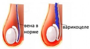 Фото: Чем опасно заболевание?