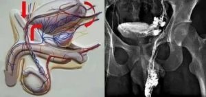 Фото: Углубленное обследование